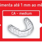 Alinhadores transparentes: entenda a relação entre complexidade X quantidade de etapas