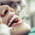 Formulário de prescrição CA CLEAR ALIGNER: saiba mais